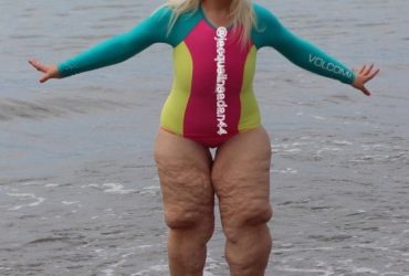 She Put On Her Bathing Suit and Everyone She Passed Was Making Fun of Her.