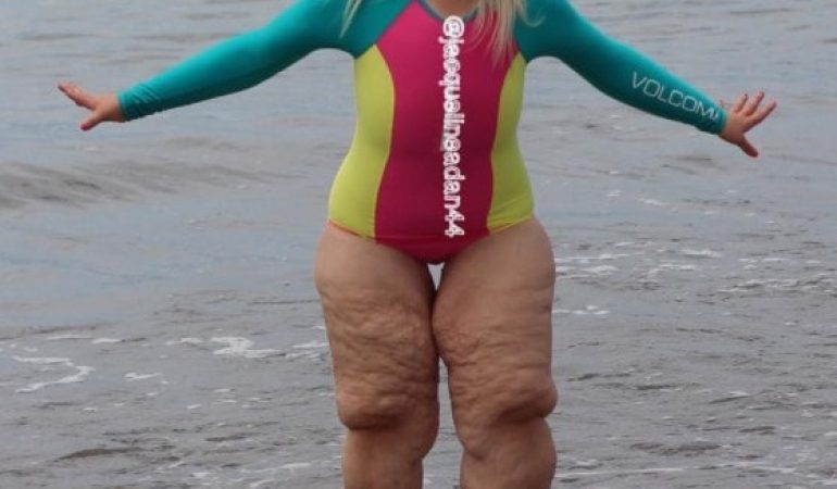 She Put On Her Bathing Suit and Everyone She Passed Was Making Fun of Her.