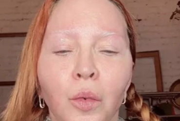 Madonna’s Altered Look in New Photos Raises Concerns about Her Well-being.