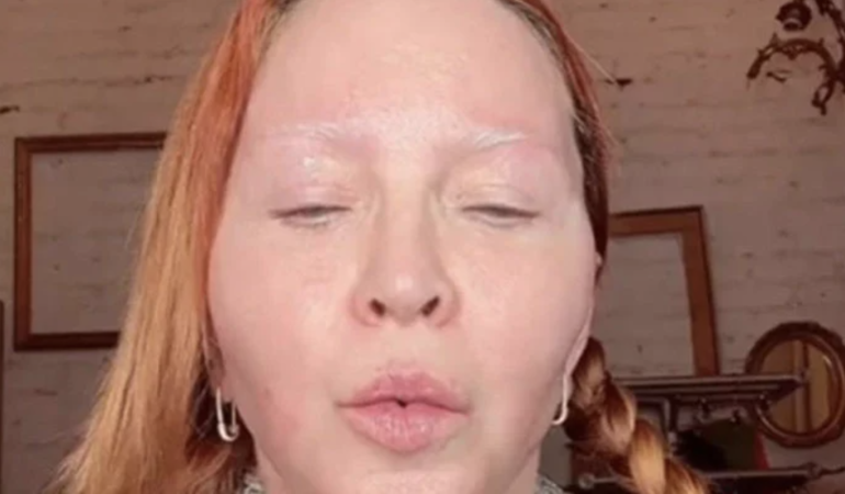 Madonna’s Altered Look in New Photos Raises Concerns about Her Well-being.