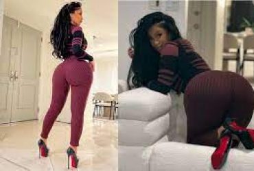 Cardi B Removes Butt Injections- Warns Followers On Getting Plastic Surgery