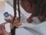 More Young Women Are Developing Type 2 Diabetes.