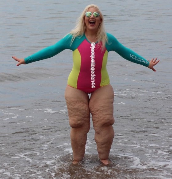 She Put On Her Bathing Suit and Everyone She Passed Was Making Fun of Her.